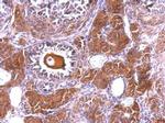 NLK Antibody in Immunohistochemistry (Paraffin) (IHC (P))