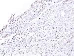 NUP62 Antibody in Immunohistochemistry (Paraffin) (IHC (P))