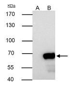 NUP62 Antibody in Immunoprecipitation (IP)