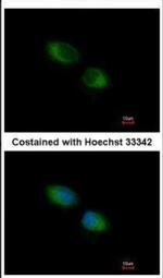 TMX Antibody in Immunocytochemistry (ICC/IF)