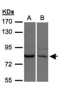 XPR1 Antibody in Western Blot (WB)
