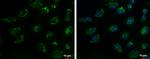 TIM17 Antibody in Immunocytochemistry (ICC/IF)