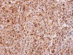 Interferon alpha-2 Antibody in Immunohistochemistry (Paraffin) (IHC (P))