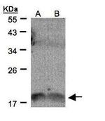 IL1F9 Antibody in Western Blot (WB)