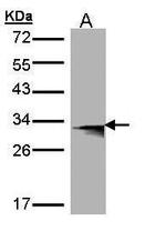 HLA-DMB Antibody in Western Blot (WB)