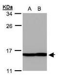 Profilin 2 Antibody in Western Blot (WB)