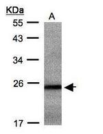 RAB2B Antibody in Western Blot (WB)