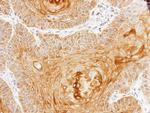 Cytokeratin 10 Antibody in Immunohistochemistry (IHC)