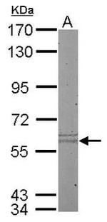 Cytokeratin 10 Antibody in Western Blot (WB)