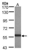 Cytokeratin 10 Antibody in Western Blot (WB)