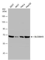 SLC25A13 Antibody in Western Blot (WB)