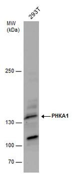 PHKA1 Antibody in Western Blot (WB)