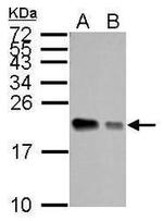 APRT Antibody in Western Blot (WB)