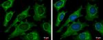 DECR1 Antibody in Immunocytochemistry (ICC/IF)