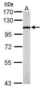 PCAF Antibody in Western Blot (WB)