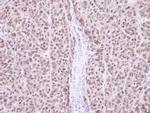 RAG2 Antibody in Immunohistochemistry (Paraffin) (IHC (P))