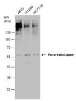 PNLIP Antibody in Western Blot (WB)