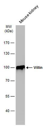 Villin Antibody in Western Blot (WB)