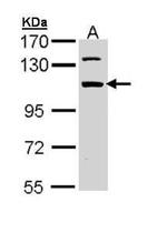 RBM28 Antibody in Western Blot (WB)