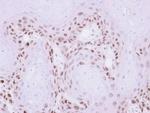 MAGEA11 Antibody in Immunohistochemistry (Paraffin) (IHC (P))