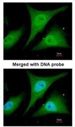 IkB alpha Antibody in Immunocytochemistry (ICC/IF)