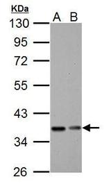 IkB alpha Antibody in Western Blot (WB)