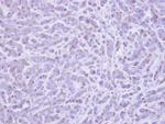 RAB6A Antibody in Immunohistochemistry (Paraffin) (IHC (P))