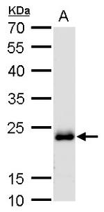 RAB6A Antibody in Western Blot (WB)