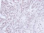 JMJD6 Antibody in Immunohistochemistry (Paraffin) (IHC (P))