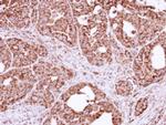 FIS1 Antibody in Immunohistochemistry (Paraffin) (IHC (P))