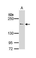 UNC13B Antibody in Western Blot (WB)