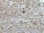 ULK2 Antibody in Immunohistochemistry (Paraffin) (IHC (P))