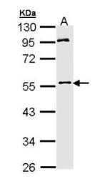 MPP1 Antibody in Western Blot (WB)