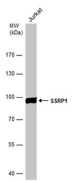 SSRP1 Antibody in Western Blot (WB)