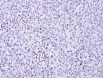 Cyclin T2 Antibody in Immunohistochemistry (Paraffin) (IHC (P))