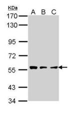 CLN2 Antibody in Western Blot (WB)