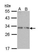 Prodynorphin Antibody in Western Blot (WB)