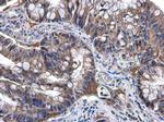 NAT1 Antibody in Immunohistochemistry (Paraffin) (IHC (P))