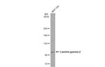 Laminin gamma-2 Antibody in Western Blot (WB)