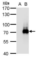 TRIM32 Antibody in Western Blot (WB)