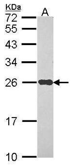 NDUFS8 Antibody in Western Blot (WB)