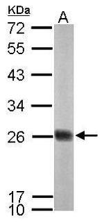 NDUFS8 Antibody in Western Blot (WB)