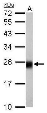 NDUFS8 Antibody in Western Blot (WB)