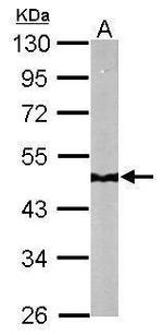 NDUFS2 Antibody in Western Blot (WB)