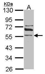 ALDH1A2 Antibody in Western Blot (WB)