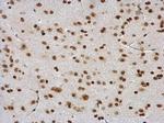 DDX56 Antibody in Immunohistochemistry (Paraffin) (IHC (P))