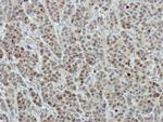 DDX56 Antibody in Immunohistochemistry (Paraffin) (IHC (P))