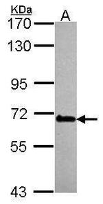 DDX56 Antibody in Western Blot (WB)