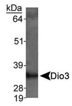 DIO3 Antibody in Western Blot (WB)