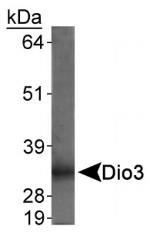 DIO3 Antibody in Western Blot (WB)
